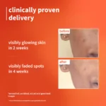 1% Vitamin C Ultra-Light-Glow Boosting Gel Cream with Alpha Arbutin