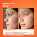 10% Vitamin C Barrier Boosting + Glow Serum with Calendula