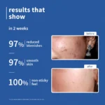 10% Niacinamide & Rice Water Brightening Face Serum - Image 4