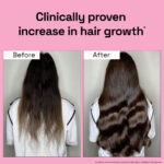 2X Rosemary for Hair Fall Control + Hair Growth Boost - Image 7