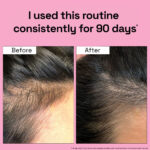2X Rosemary for Hair Fall Control + Hair Growth Boost - Image 6