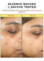 10% Vit C Serum with 1% Vit E & Ferulic Acid | Clinically Tested - Image 8