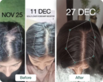 4X Rosemary Booster for Rapid Hair Growth - Image 6
