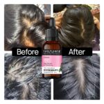 Clinically Tested Rosemary Essential Oil for Hair Growth (30ml * 3) - Image 4