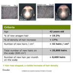 Anti Dandruff + Hair Growth Treatment - Image 9