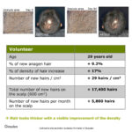 Rosemary Redensyl Hair Growth Serum BYOB - Image 12
