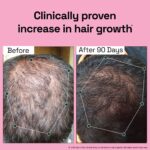 Rosemary Redensyl Hair Growth Serum - Image 3