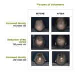 Frizz-free Hair Growth Routine - Image 5