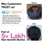 Rosemary Lavender Hair Growth Oil - Image 3