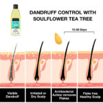 Complete Routine for Excessive Dandruff - Image 9