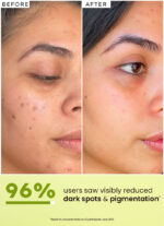 BRIGHTENING FACE SERUM - 5% NIACINAMIDE 1% ALPHA ARBUTIN 25% KAKADU PLUM - Image 4