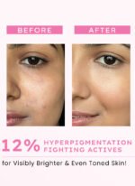 Advanced Glow Serum With 3% Tranexamic Acid & 2% Kojic Acid - 30 ml - Image 4