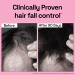 Soulflower Rosemary Essential Oil for Hair Growth – 100% Pure Natural Oil (30ml) - Image 4