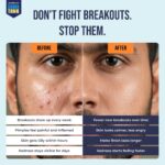 Acne Defense Mucin Serum - Image 3