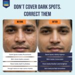 Spot Zero Mucin Serum - Image 3