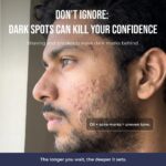 Spot Zero Mucin Serum - Image 4