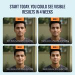 Spot Zero Mucin Serum - Image 7