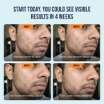 Acne Defense Mucin Serum - Image 7